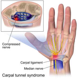 median-nerve-24-7-medcare